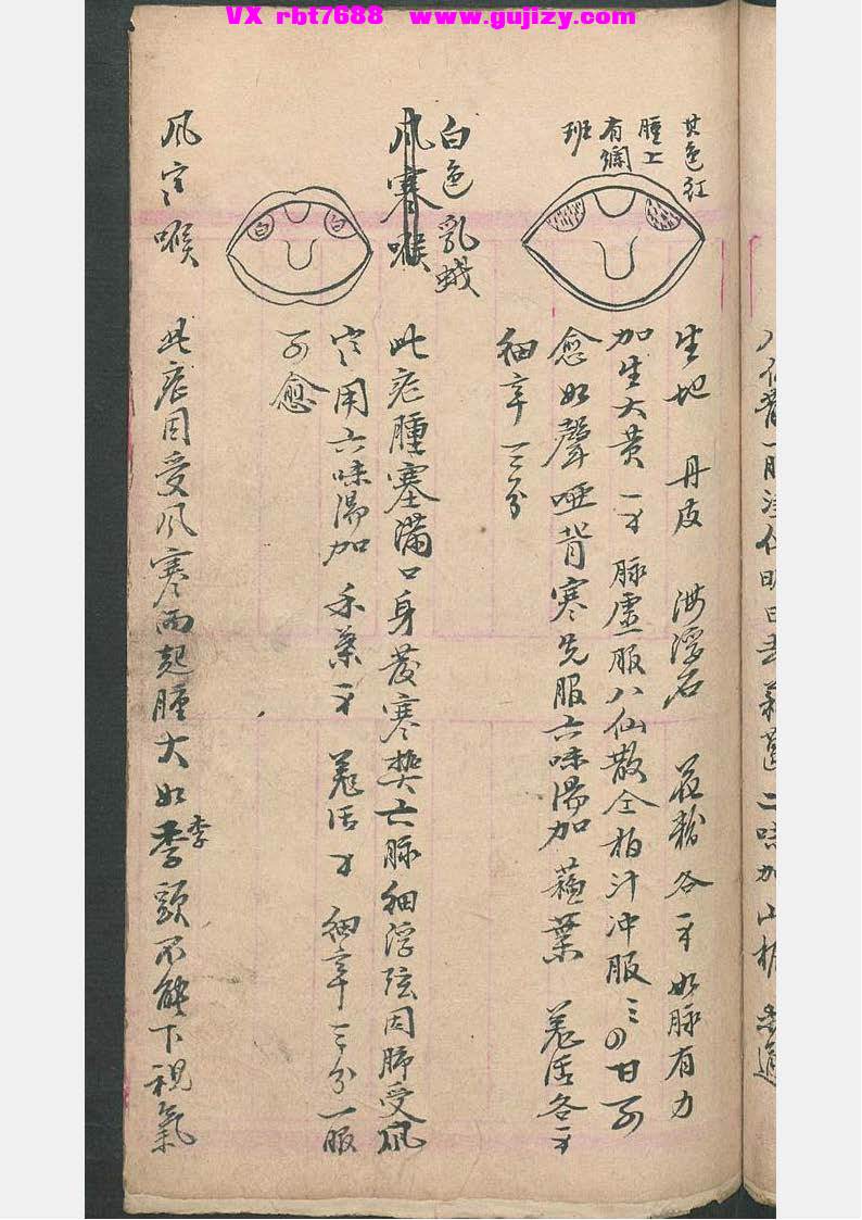页面提取自－民间喉舌方抄本-54页_页面_3.jpg