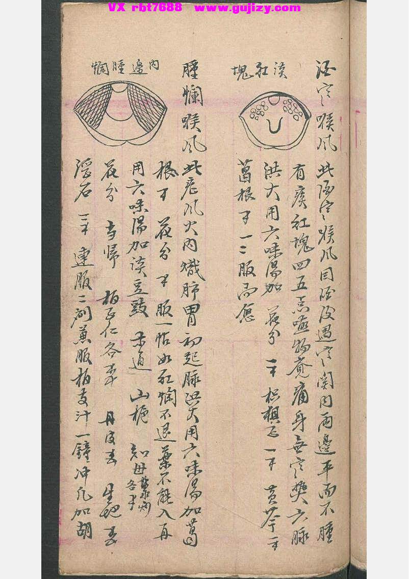 页面提取自－民间喉舌方抄本-54页_页面_4.jpg